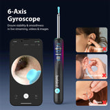 Wax Removal Earscope, Ear Canal Cleaner with HD