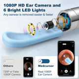 Ear Wax Removal, Ear Wax Removal Tool Camera with 1080P HD Smart Visual